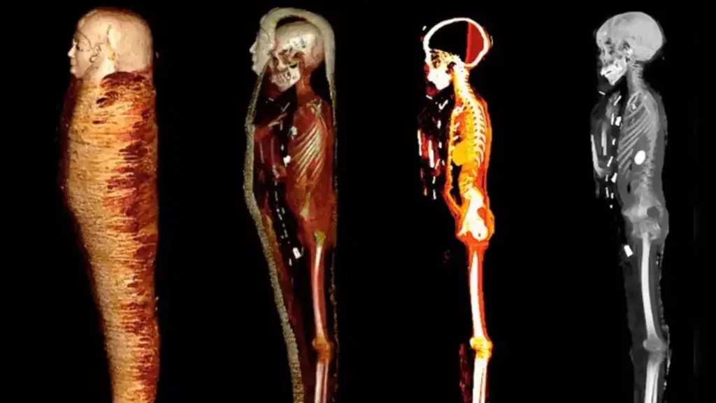 7 New Discoveries In Egypt 2023 18 Advanced CT Scans of Mummified Teenage Boy