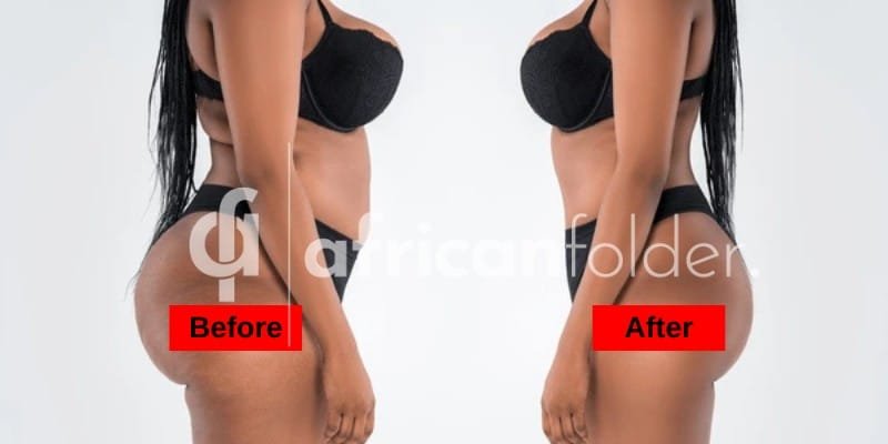 10 Effective Home Remedies For Flat Tummy You Can Try Today